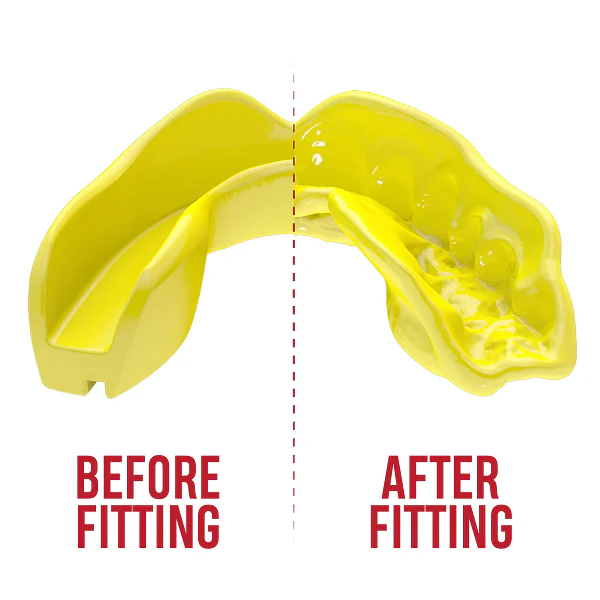 Safejawz Intro Range Mouthguard Fluro Yellow - Image 2