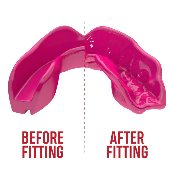 Safejawz Intro Range Mouthguard Pink - Image 2